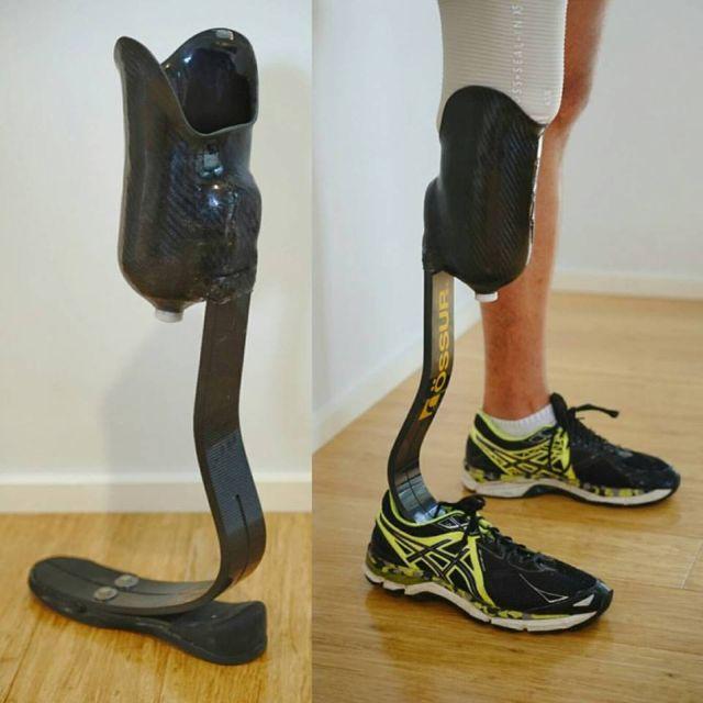 Hip Disarticulation Prosthesis