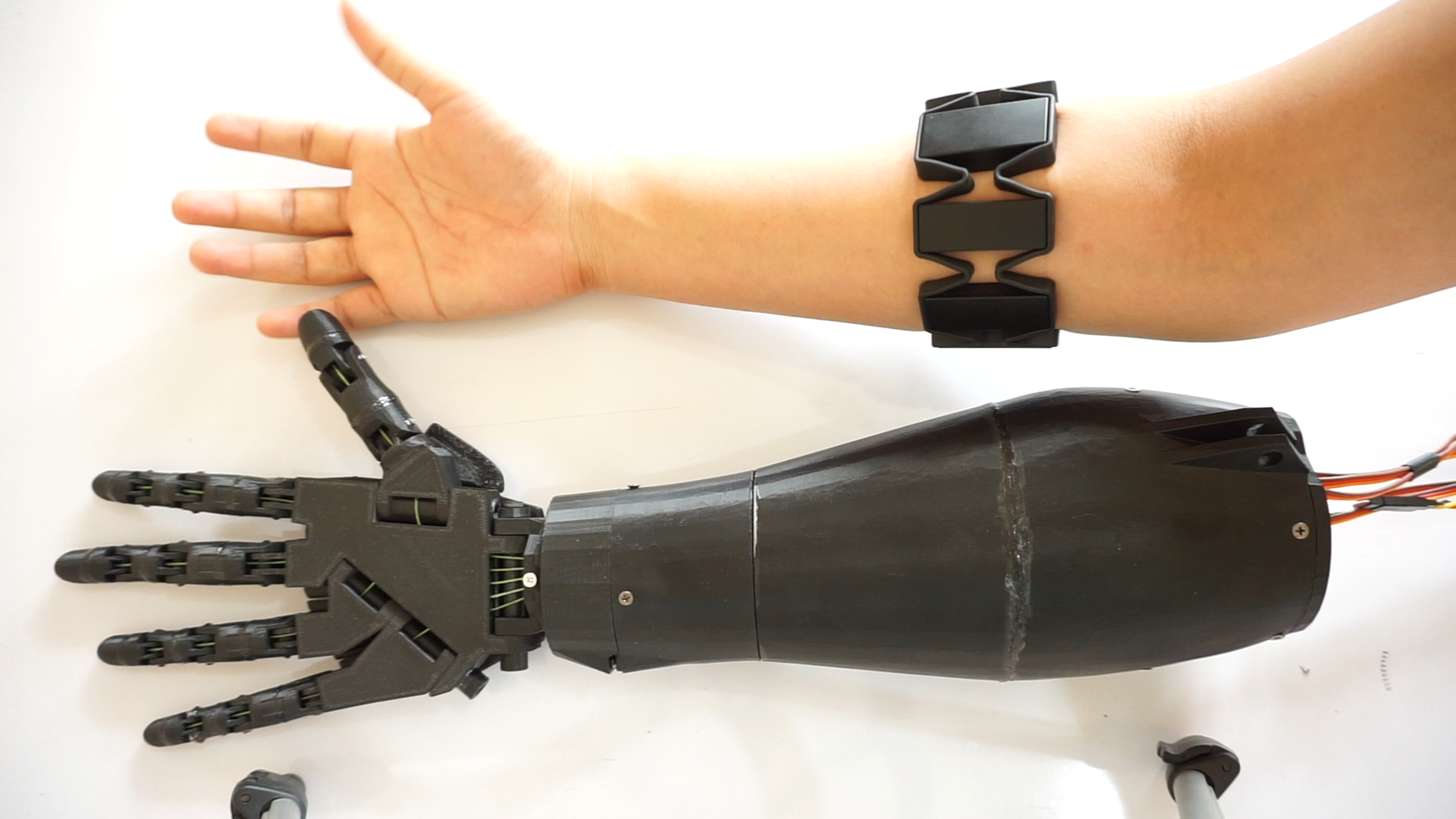 Myoelectric Prosthetic Hand