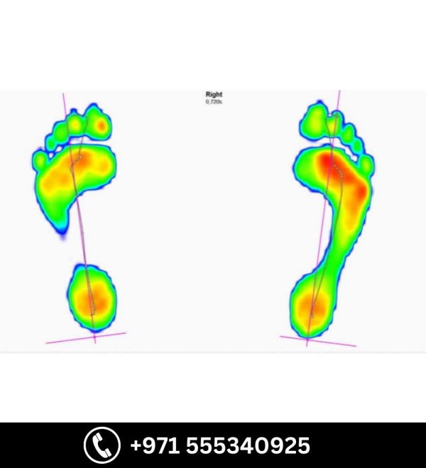 3D Print Custom Made Insole