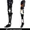 Knee Ankle Foot Orthosis (KAFO) Knee Ankle Foot Orthosis