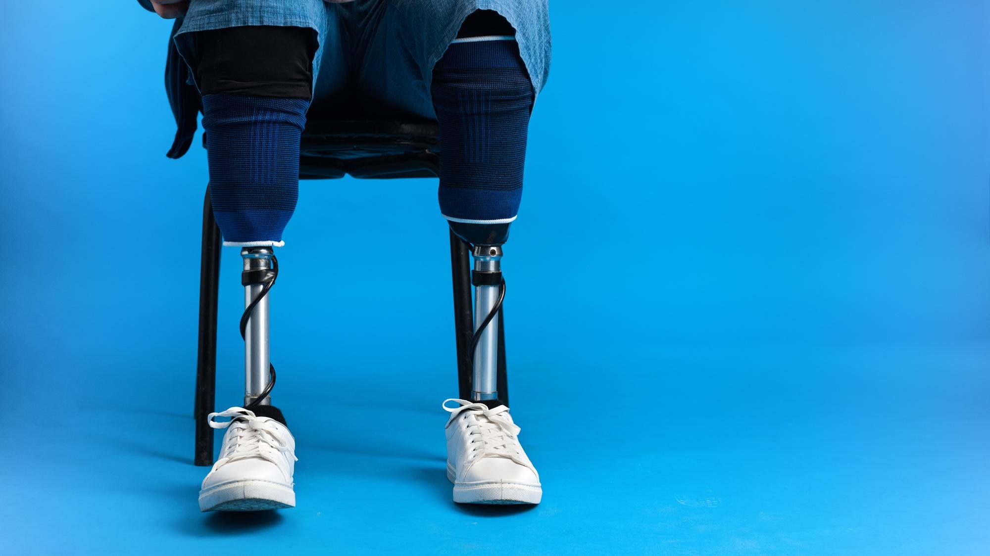 Prosthetic devices suppliers Dubai