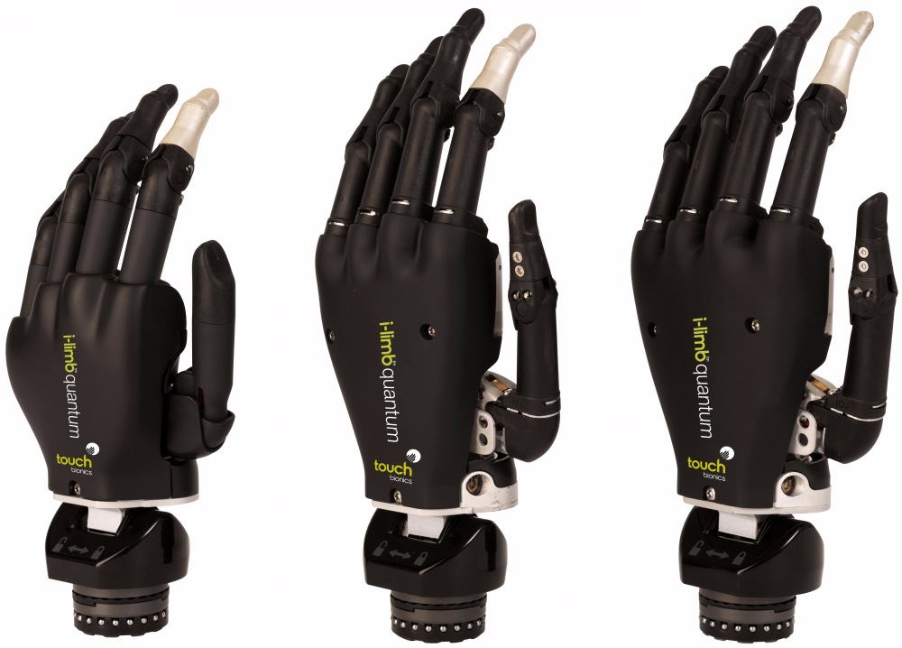 Touch Bionics Prosthetic Hand