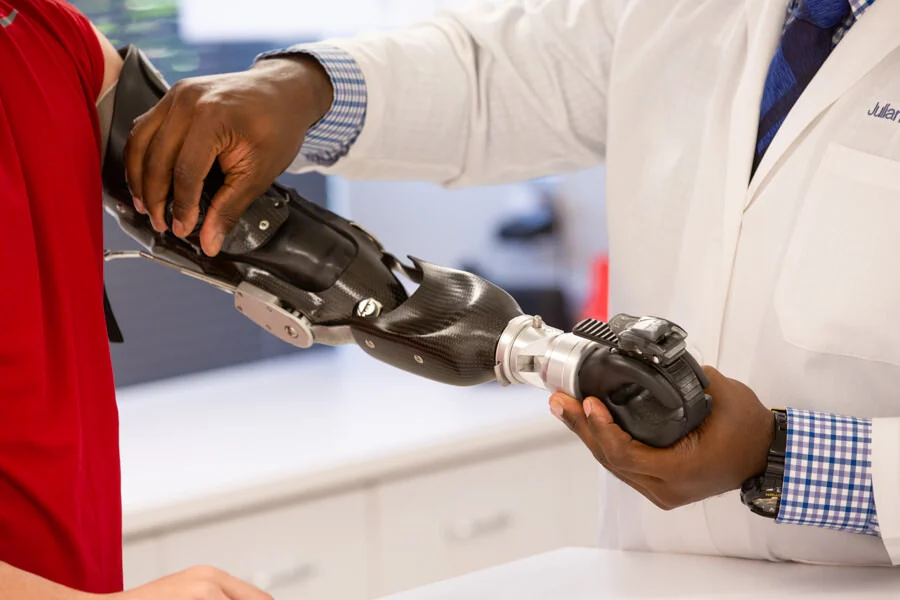 Below-Elbow Prosthetic Hand