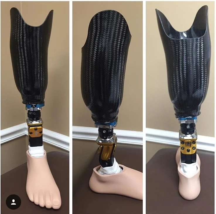 Above knee prosthesis Dubai