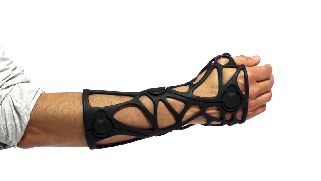 Orthotic Custom-made orthotic devices in Dubai