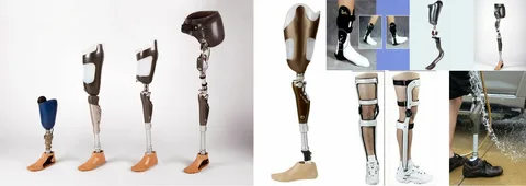 Prosthetics & orthotics manufacturer and supplier in Dubai
