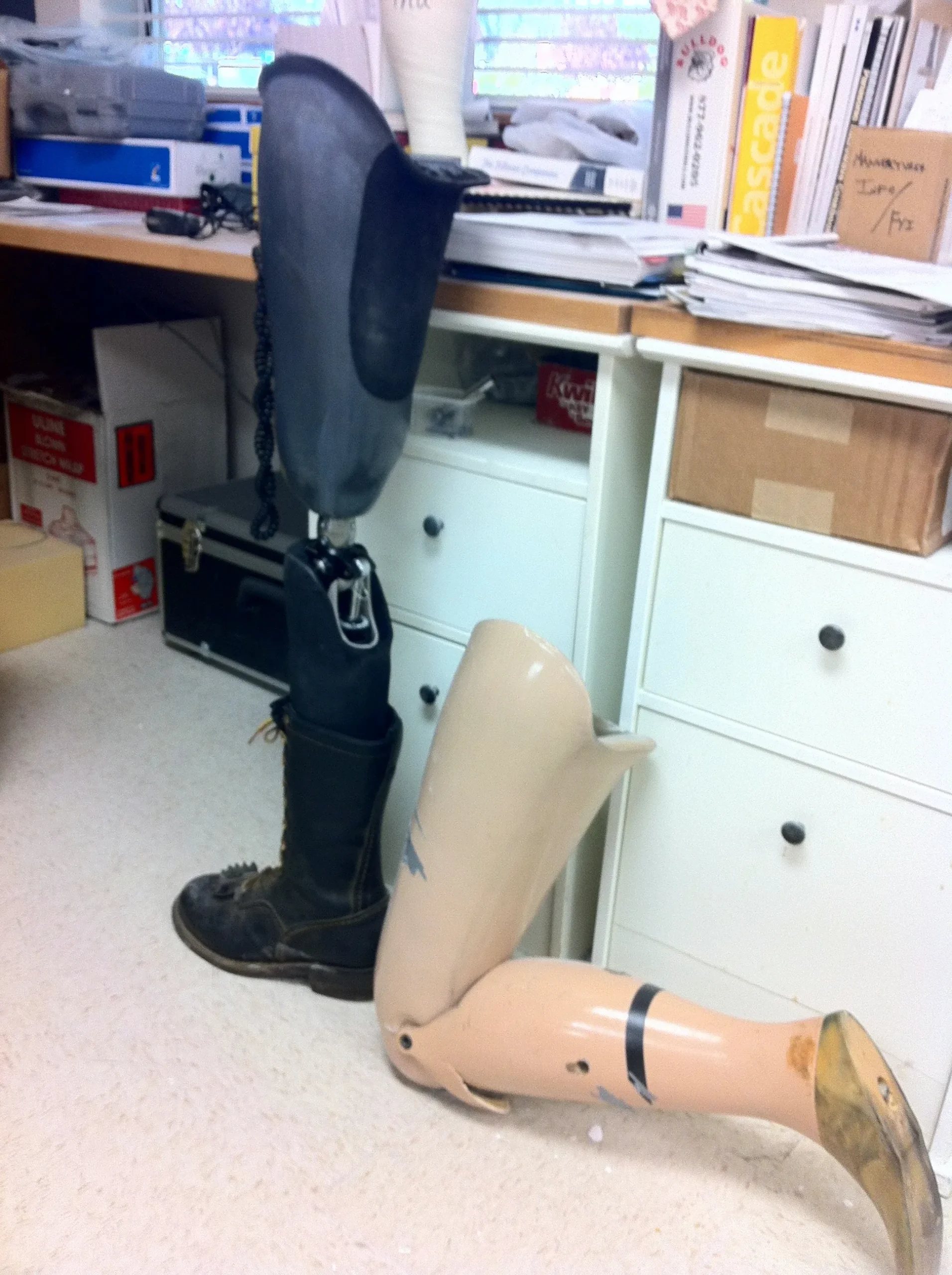 Lower limb prosthetics Dubai