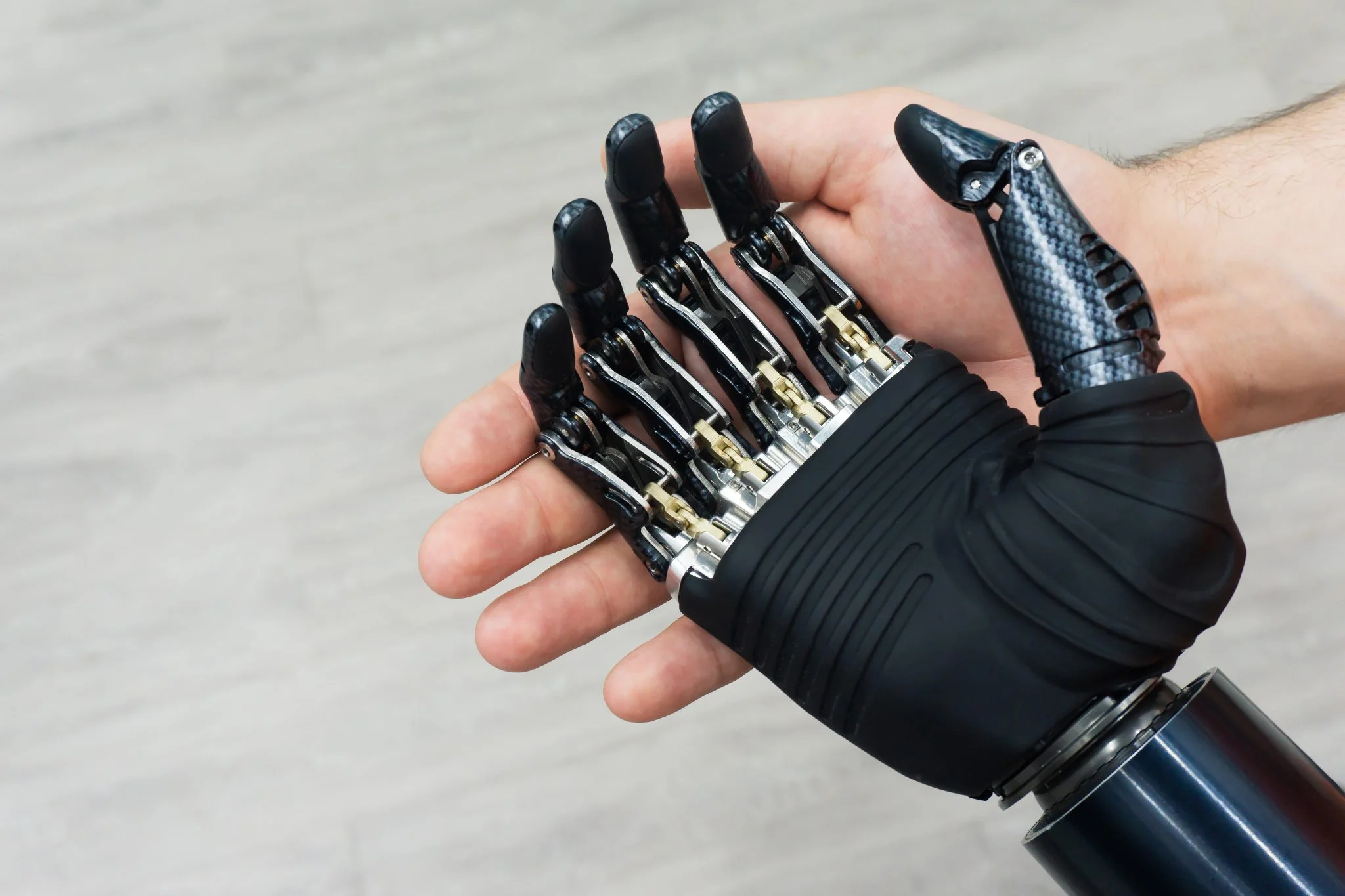 Touch Bionics Prosthetic Hand