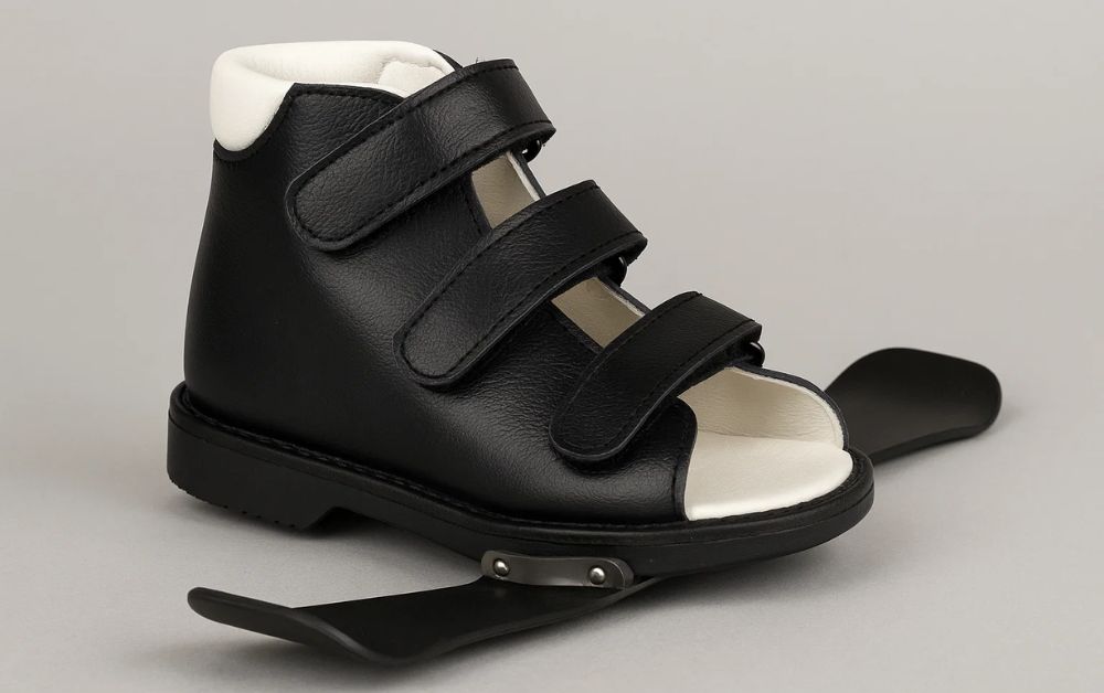 What Are Club Foot Shoes and Why Are They Important? What Are Club Foot Shoes (CTEV Shoes)?